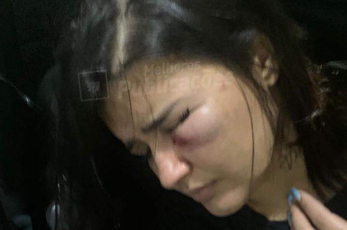 Mulher é espancada pelo ex-companheiro em Criciúma