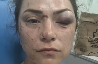 Justiça decreta prisão de homem que bateu na ex-companheira em Içara
