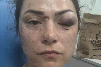 Mulher é agredida com socos em Içara 